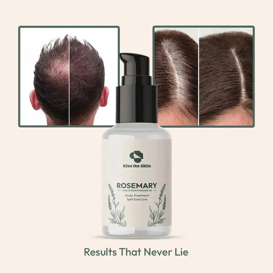 Rosemary hair strengtheniing oil Scalp Treatment Split end care- Kiss On Skin